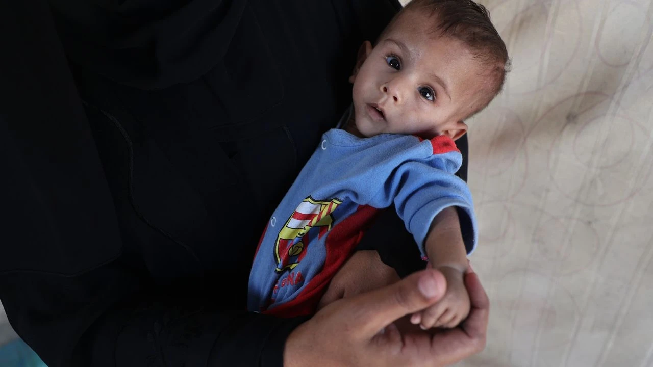 UNICEF: “Gazze’de Bebekler Yetersiz Beslenmeyle Ölüyor”