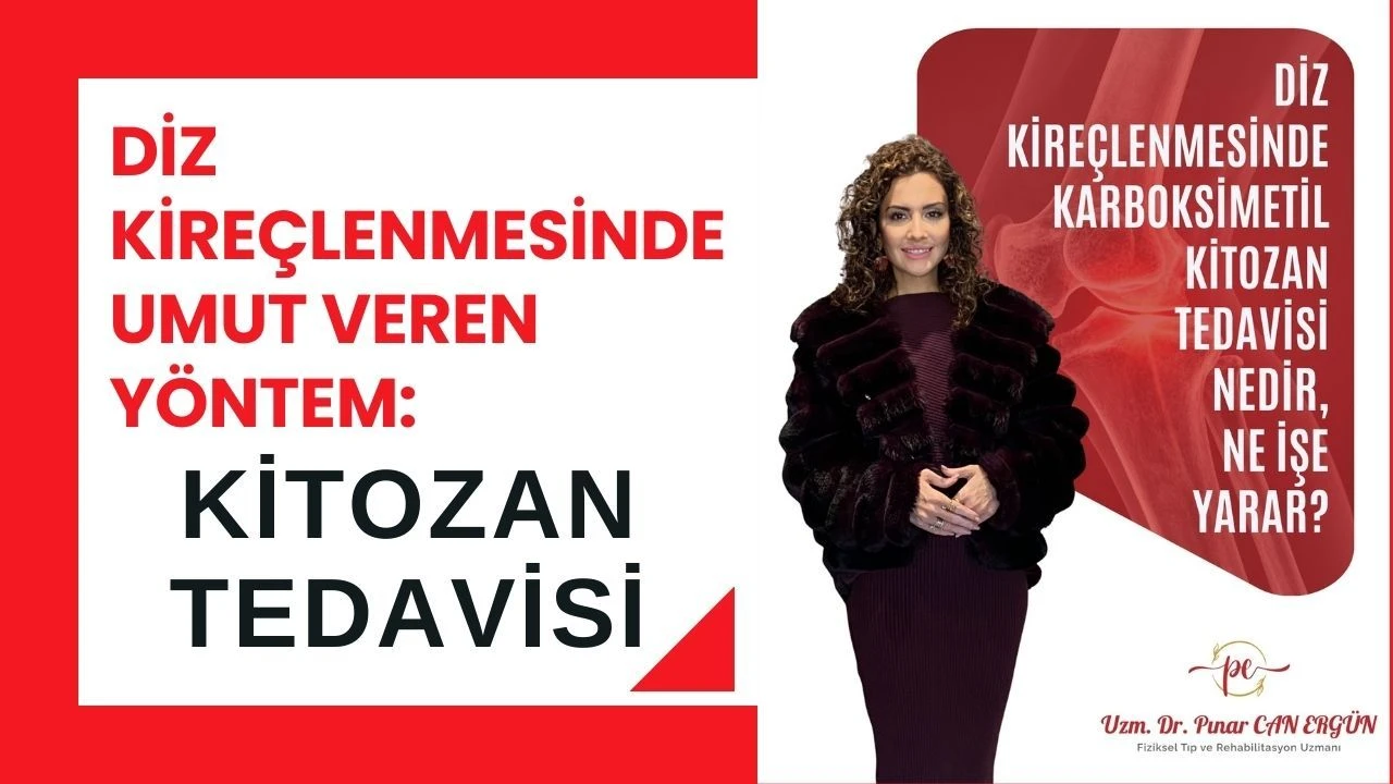 Diz Kireçlenmesinde Umut Veren Yöntem: Kitozan Tedavisi